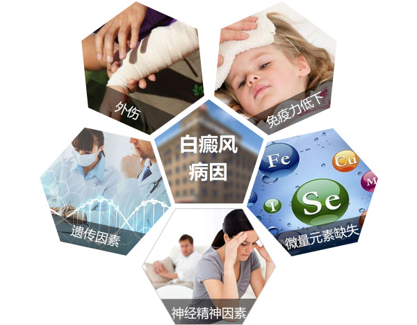 女性为什么会患上白癜风?