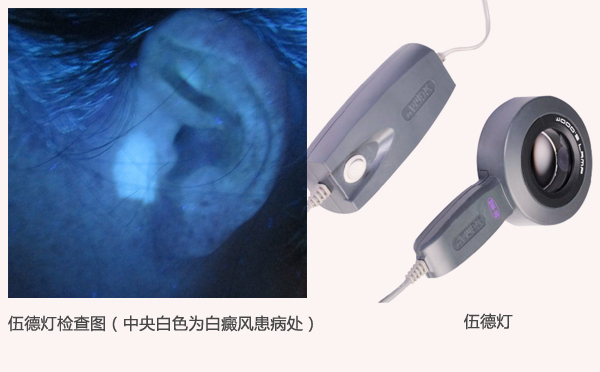 伍德灯