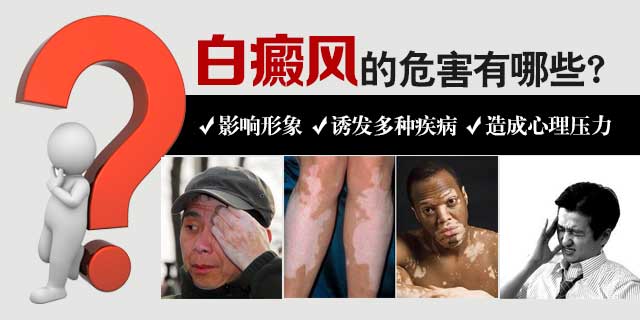 到底白癜风有什么危害_宁波好的白癜风医院
