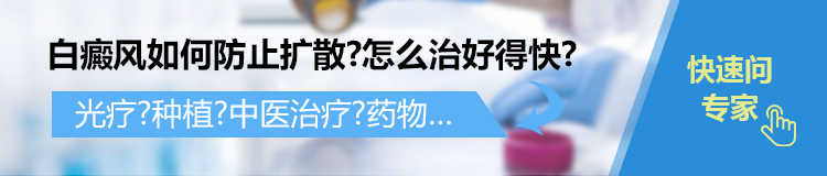 杭州白斑医院介绍:白癜风每天泡脚有好处吗?