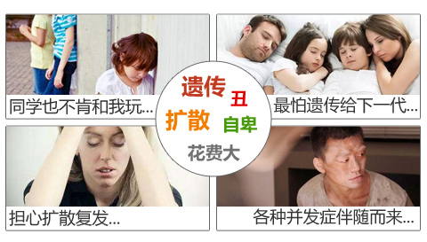 杭州治白癜风有名医院告诉你:孕妇白癜风怎么防止扩散