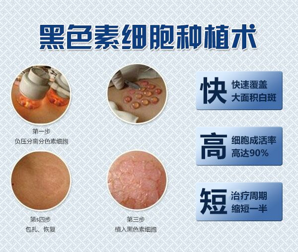 杭州小孩治疗白癜风 胳膊上有小白点白斑是怎么回事