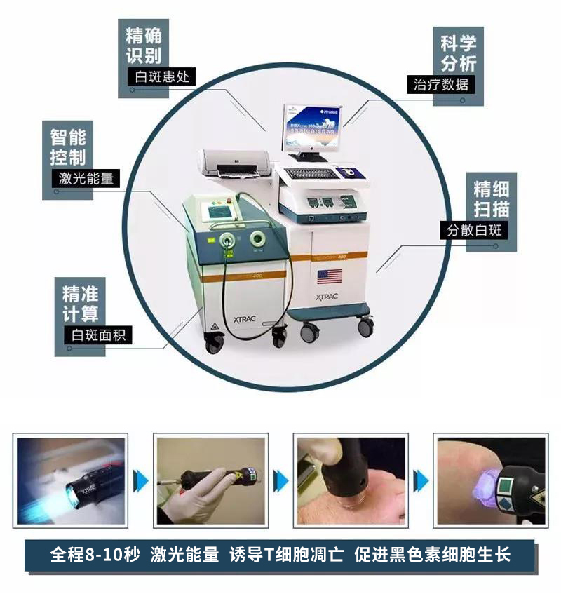 杭州治白癜风有名医院讲述:白癜风的发病率和年龄是否有关系