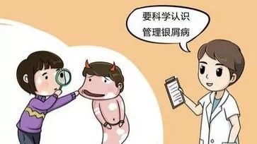 银屑病患者应该如何治疗?