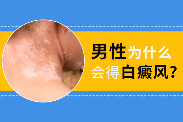 为什么男性也会得白癜风?