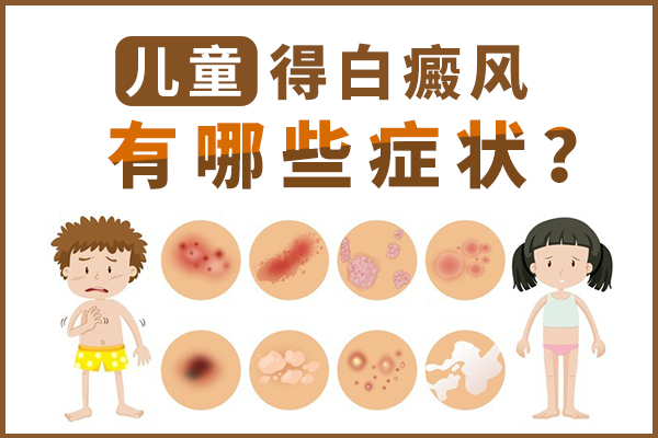 儿童白癜风早期是怎样的?