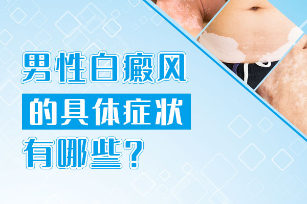 男性白癜风症状有哪些
