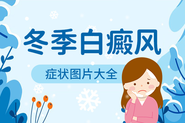 宁波老年人患上白癜风后需要注意哪些方面呢