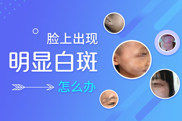 宁波最好的白癜风专科医院